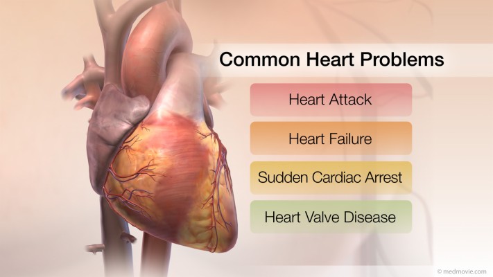 common-heart-problems-1920x1080-wallpaper-teahub-io